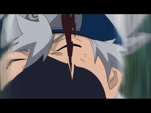 Featured image of post Kakashi Eye Scar
