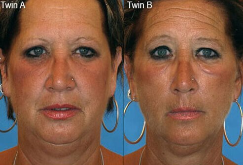 Featured image of post Smoking Effects Pictures Real