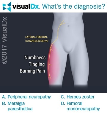 Featured image of post Tingling In Legs During Pregnancy